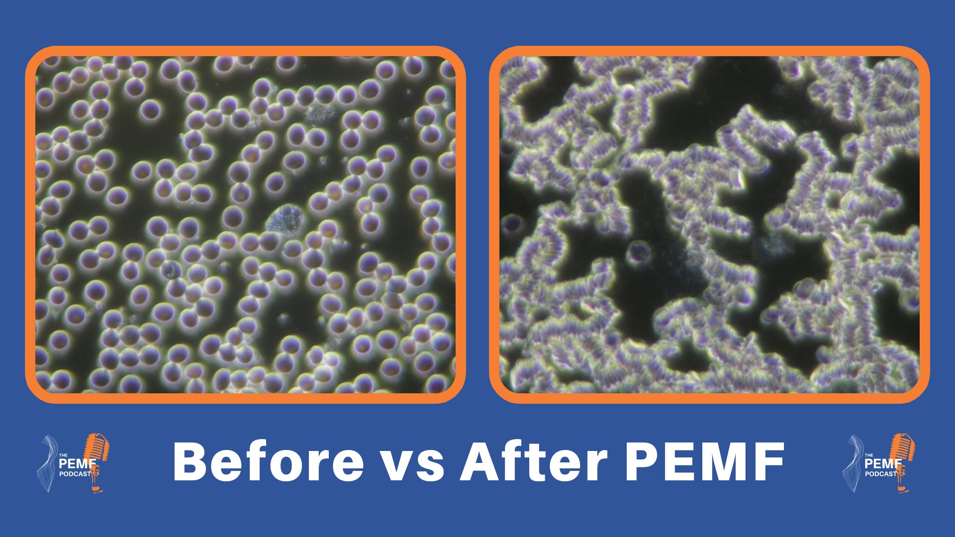 Red blood cells before and after PEMF therapy