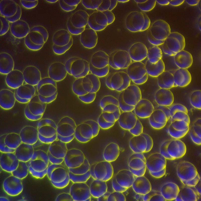 Red blood cells after a session of PEMF therapy on CELLER8