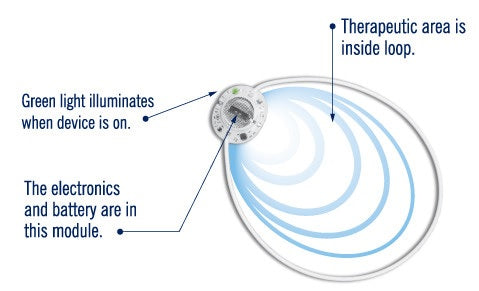 actipatch loop